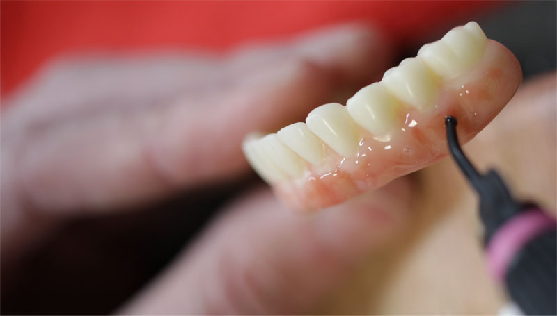 Stabili-teeth by Dr. Cuong Tran